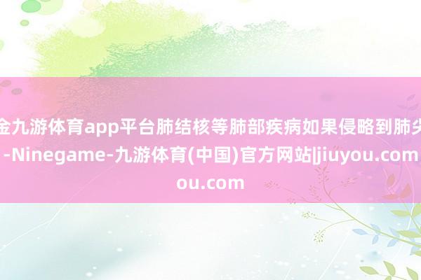 现金九游体育app平台肺结核等肺部疾病如果侵略到肺尖部-Ninegame-九游体育(中国)官方网站|jiuyou.com